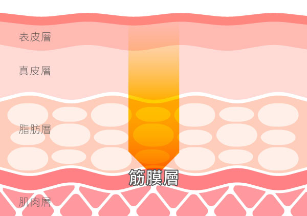 媚必提音波