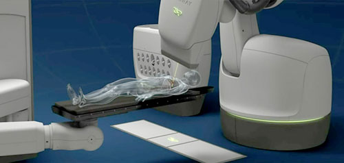 以電腦刀精準高效消融腫瘤